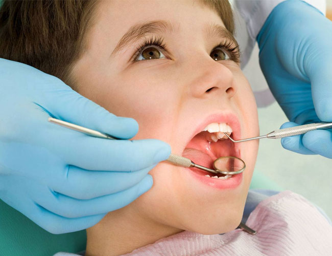 Dişlerde Amputasyon Tedavisi Nedir?